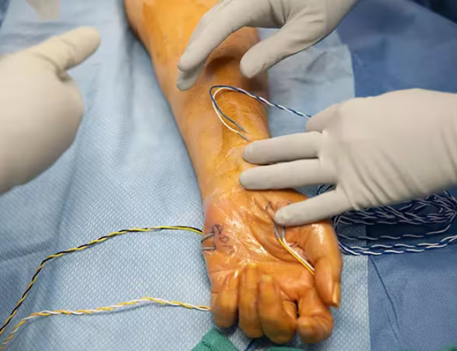 Hand and Nerve Surgery