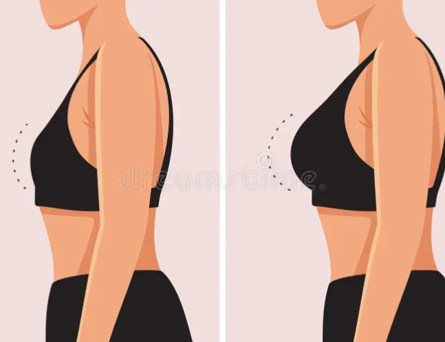 Breast Augmentation / Reduction