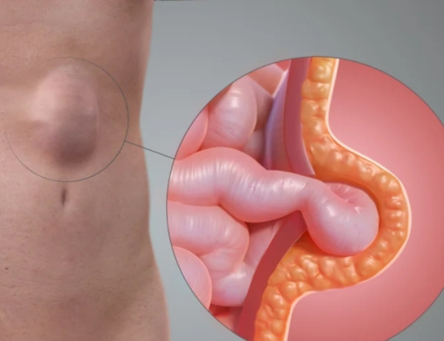 Liver, Pancreatic & Biliary Surgery