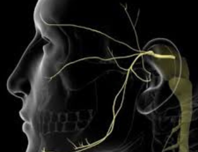 Trigeminal Neuralgia